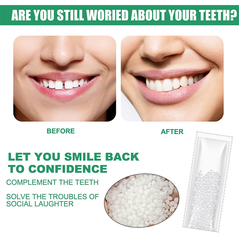 Moldable false teeth