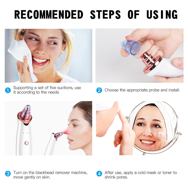 Electric pore cleaner and blackhead remover