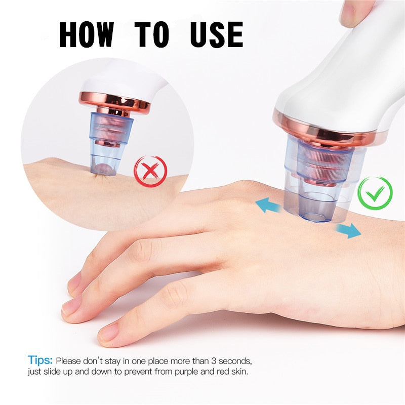 Electric pore cleaner and blackhead remover
