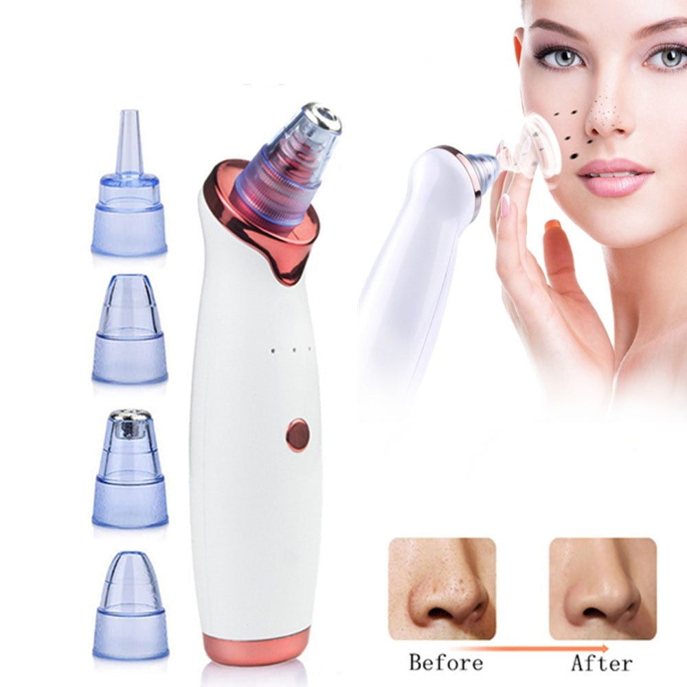 Electric pore cleaner and blackhead remover